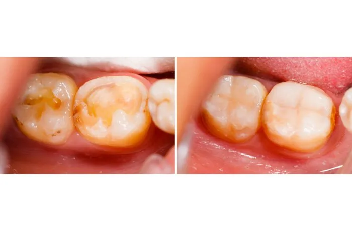 Smile Gallery at Aiken Family Dentistry in Aiken, South Carolina