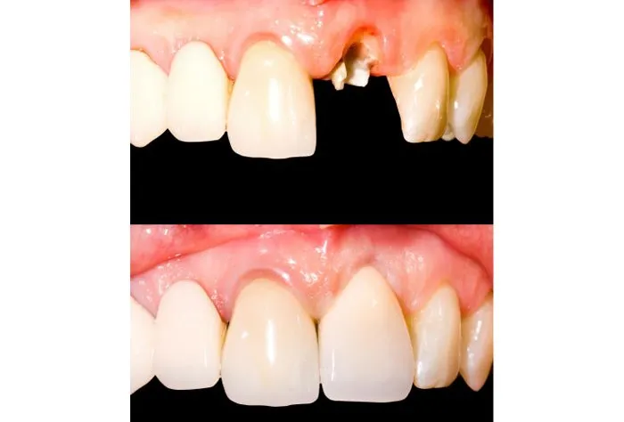 Smile Gallery at Aiken Family Dentistry in Aiken, South Carolina