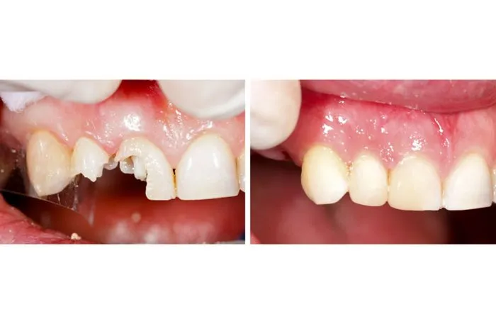 Smile Gallery at Aiken Family Dentistry in Aiken, South Carolina