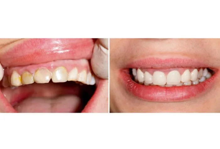 Smile Gallery at Aiken Family Dentistry in Aiken, South Carolina